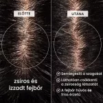Előtte-utána fotó a zsíros hajtőről és a kezelt, tiszta fejbőrről a termék hatásának bemutatására.